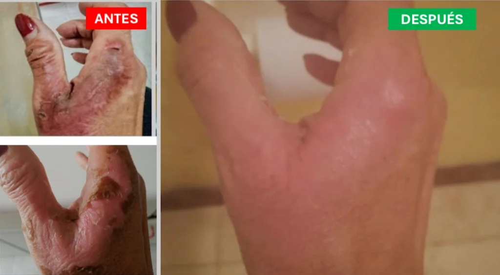 Imagen antes y después productos ZIONO3