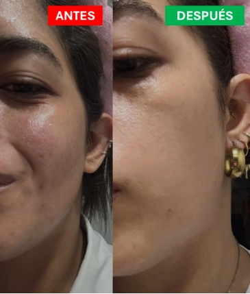 Imagen antes y después productos ZIONO3